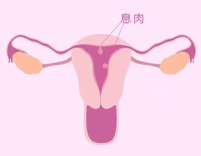 千万别忽视求子路上的这个“拦路虎”！