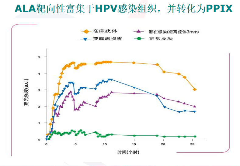 HPV感染所致疾病怎么治？了解一下光动力治疗技术